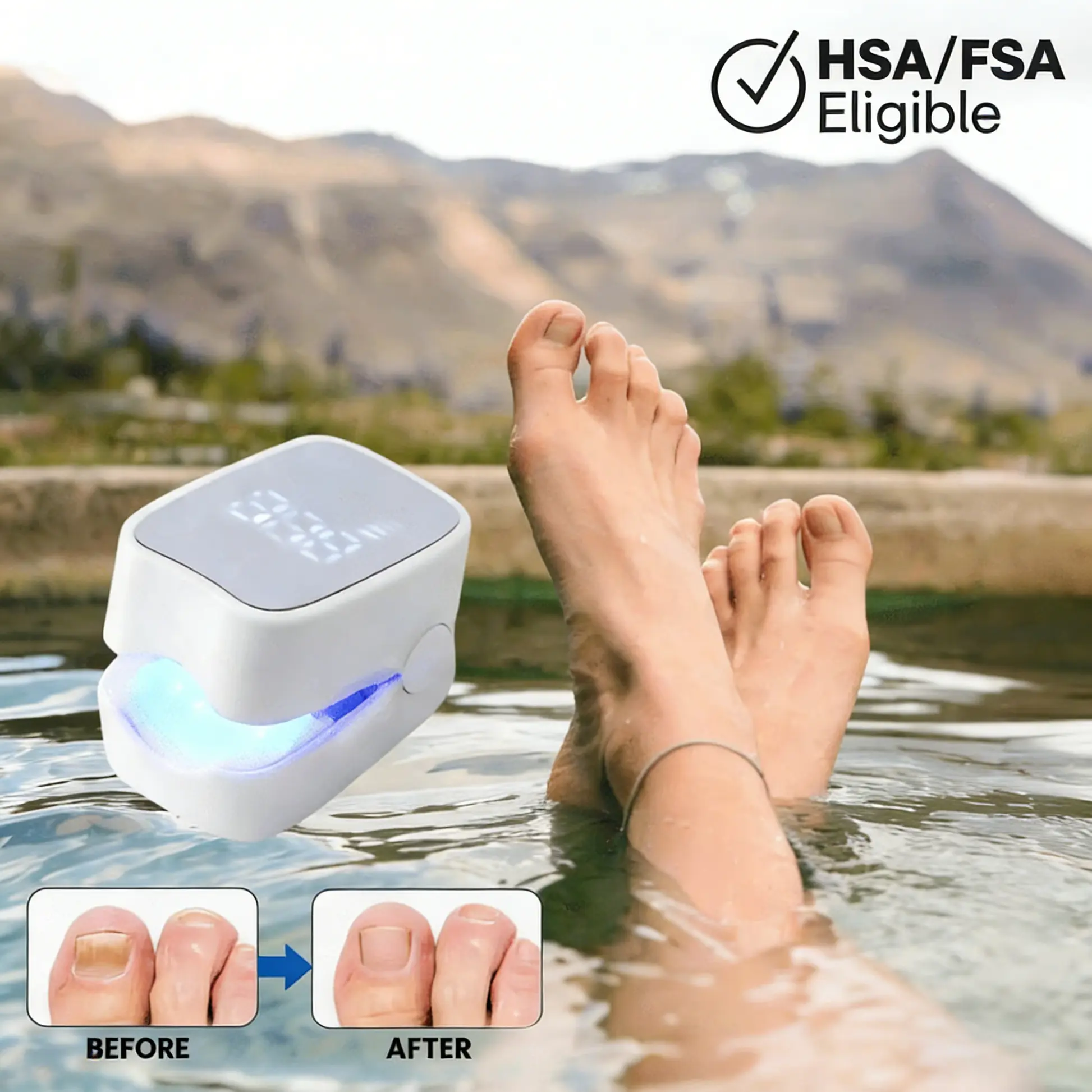 - Nail Fungus Laser Device
