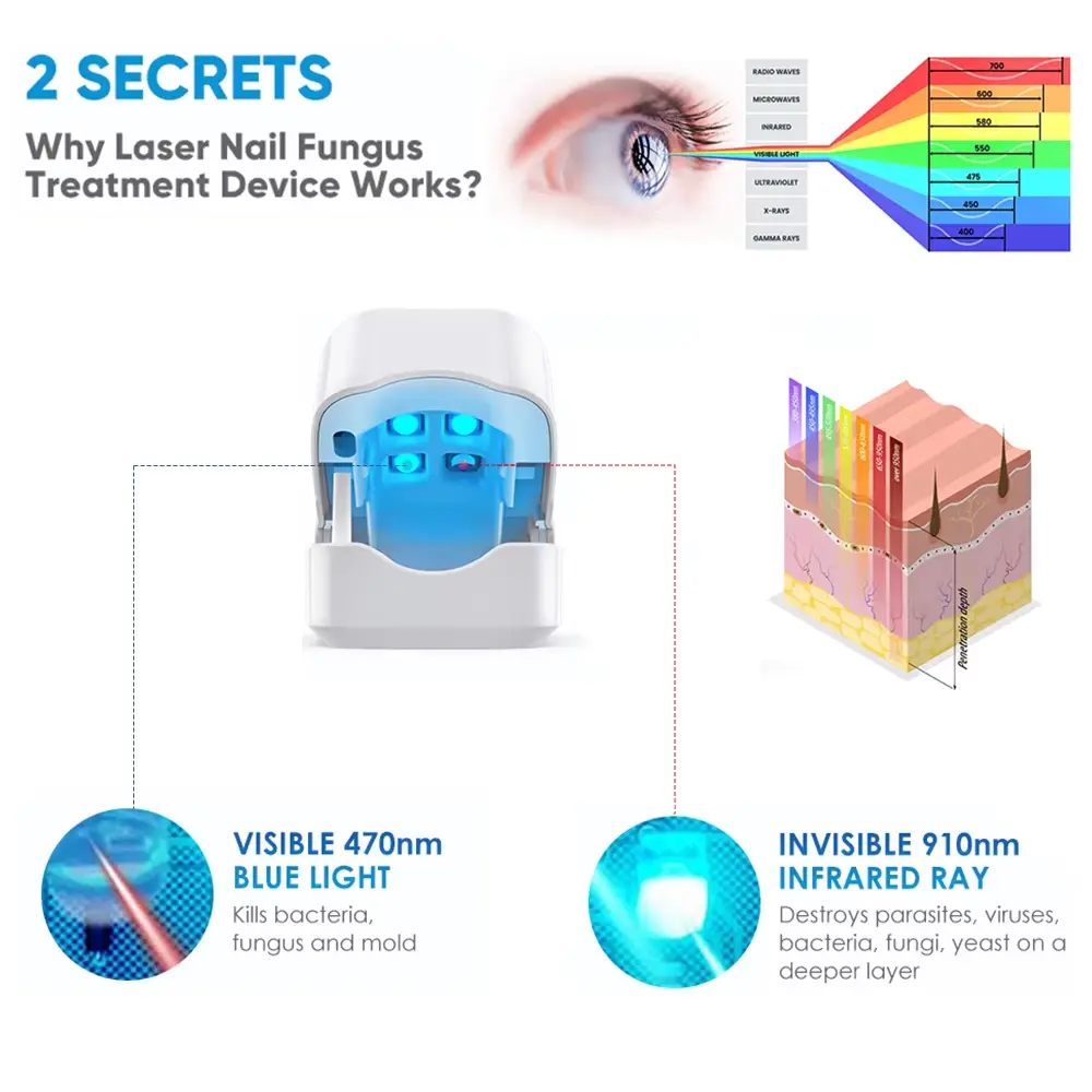 - Nail Fungus Laser Device - Image 5