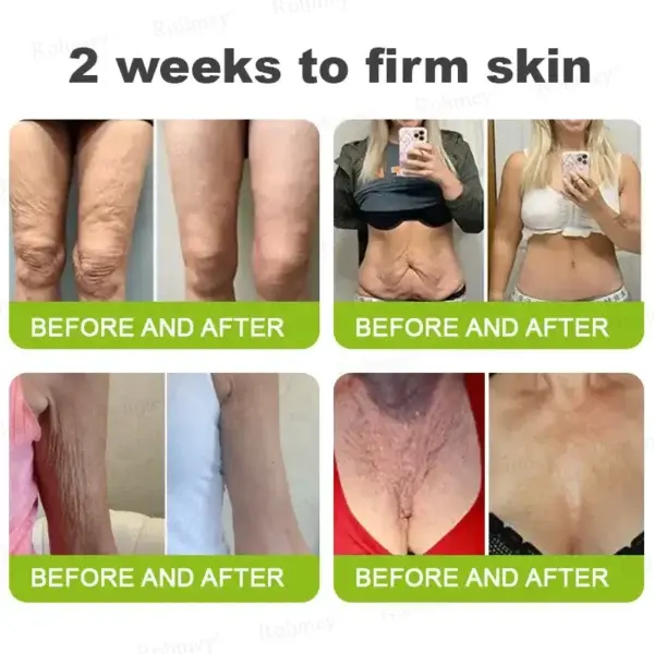 Botox & Vita-A Retinol Shot Tightening and Wrinkle-Reducing Cream - Image 9