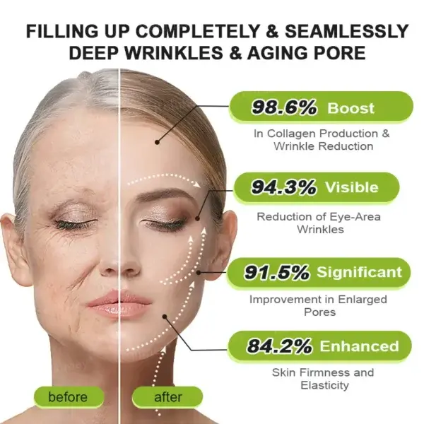 Botox & Vita-A Retinol Shot Tightening and Wrinkle-Reducing Cream - Image 4