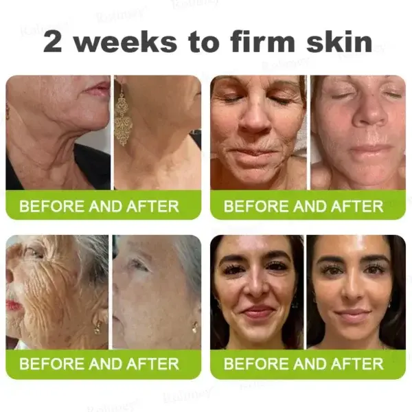 Botox & Vita-A Retinol Shot Tightening and Wrinkle-Reducing Cream - Image 8