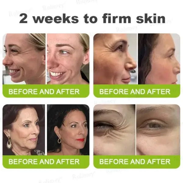 Botox & Vita-A Retinol Shot Tightening and Wrinkle-Reducing Cream - Image 7