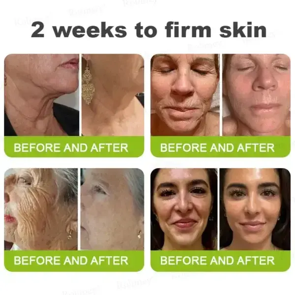 Botox & Vita-A Retinol Shot Tightening and Wrinkle-Reducing Cream - Image 8