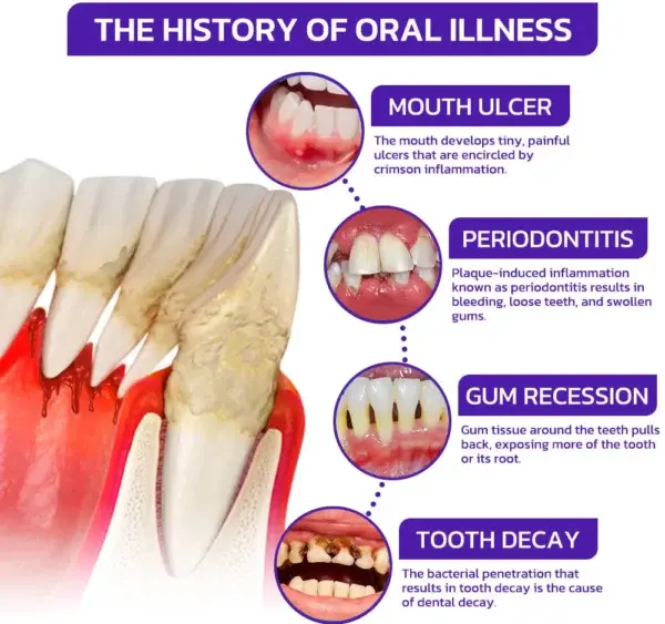 VioCore Bee Venom Dental Treatment Toothpaste - Image 13