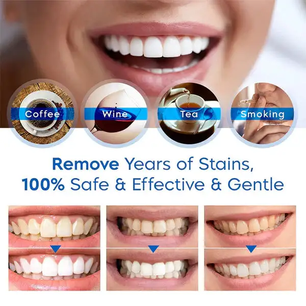 Teeth Whitening Essence - Image 4