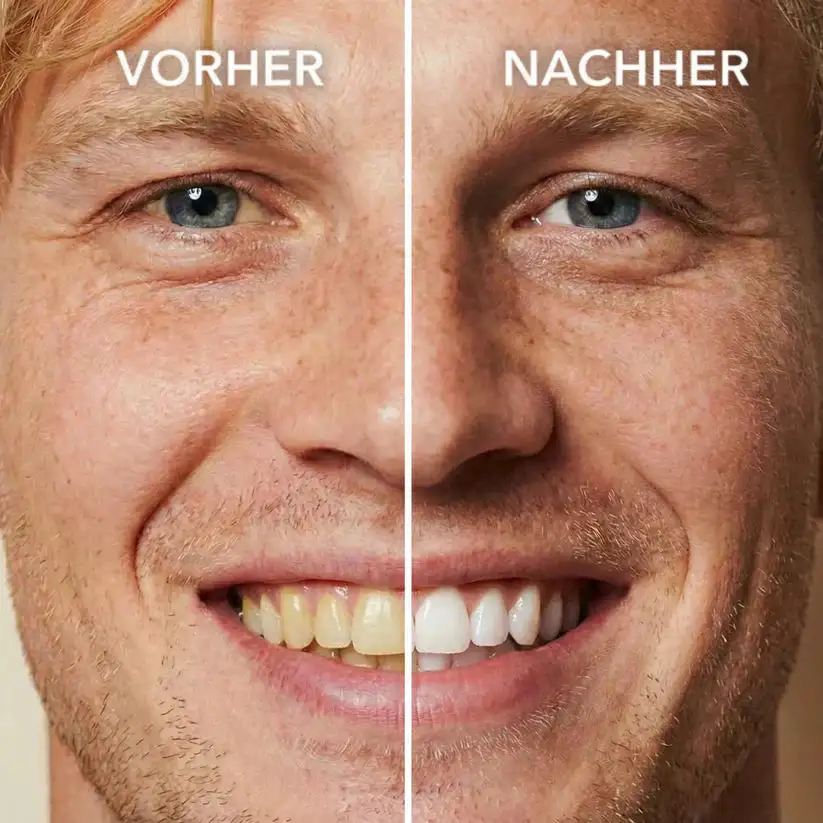 Tooth Polish - Instant Clean Smile - Image 2