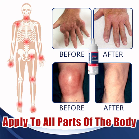 Joint and Bone Therapy Gel - Image 6