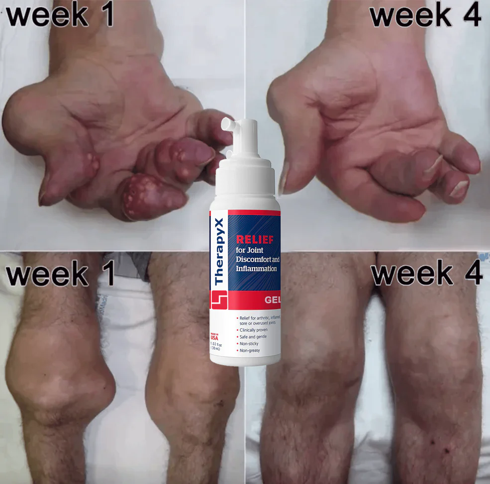 Joint and Bone Therapy Gel - Image 5
