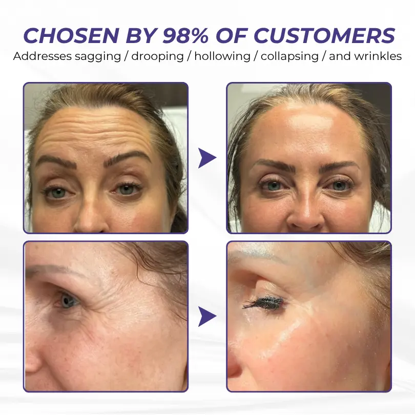 ElastaPro Emu Oil Skin Firming Cream - Image 8