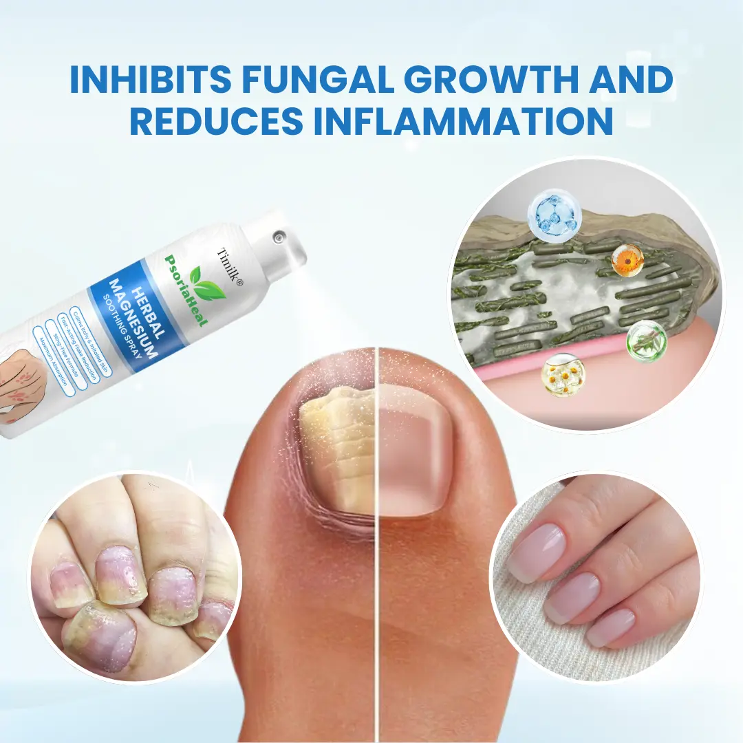 PsoriaHeal Herbal Magnesium Soothing Spray - Image 3