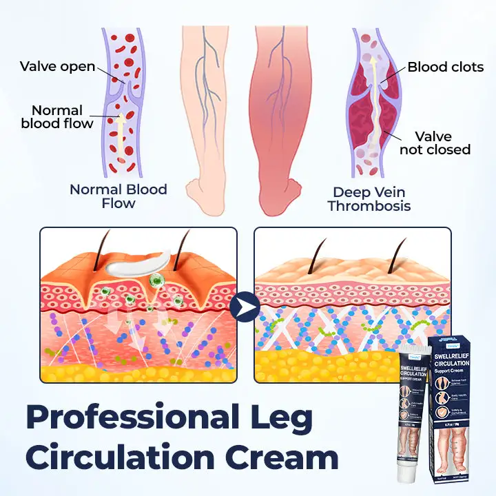 SwellRelief Circulation Support Cream - Image 4