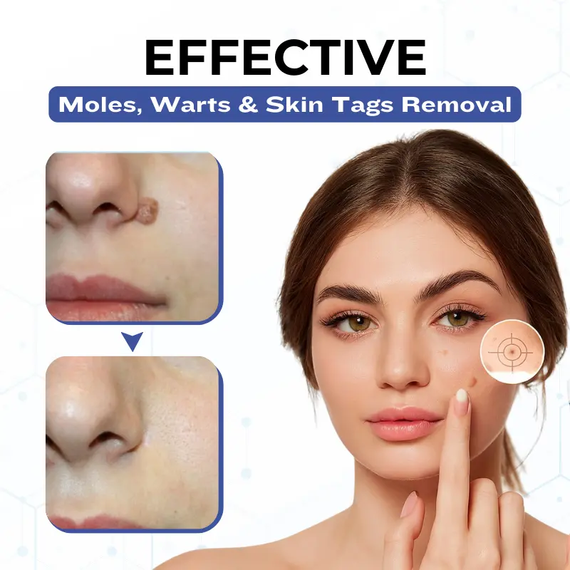 VanishPro Skin Spot Removal Cream - Image 6