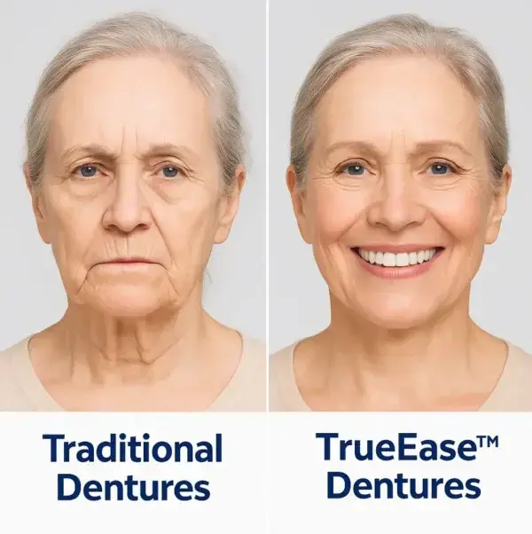 Dentures - Image 5