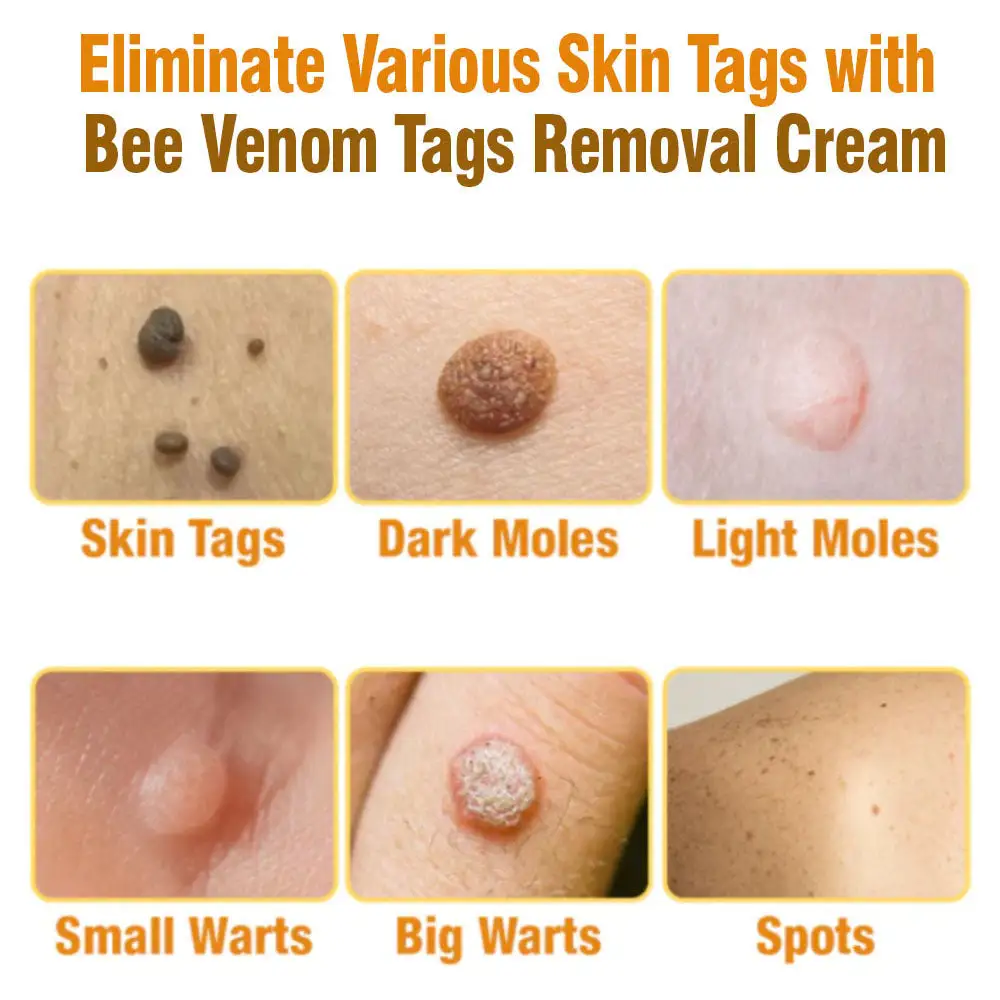 Bee Venom Tags Removal Cream - Image 2