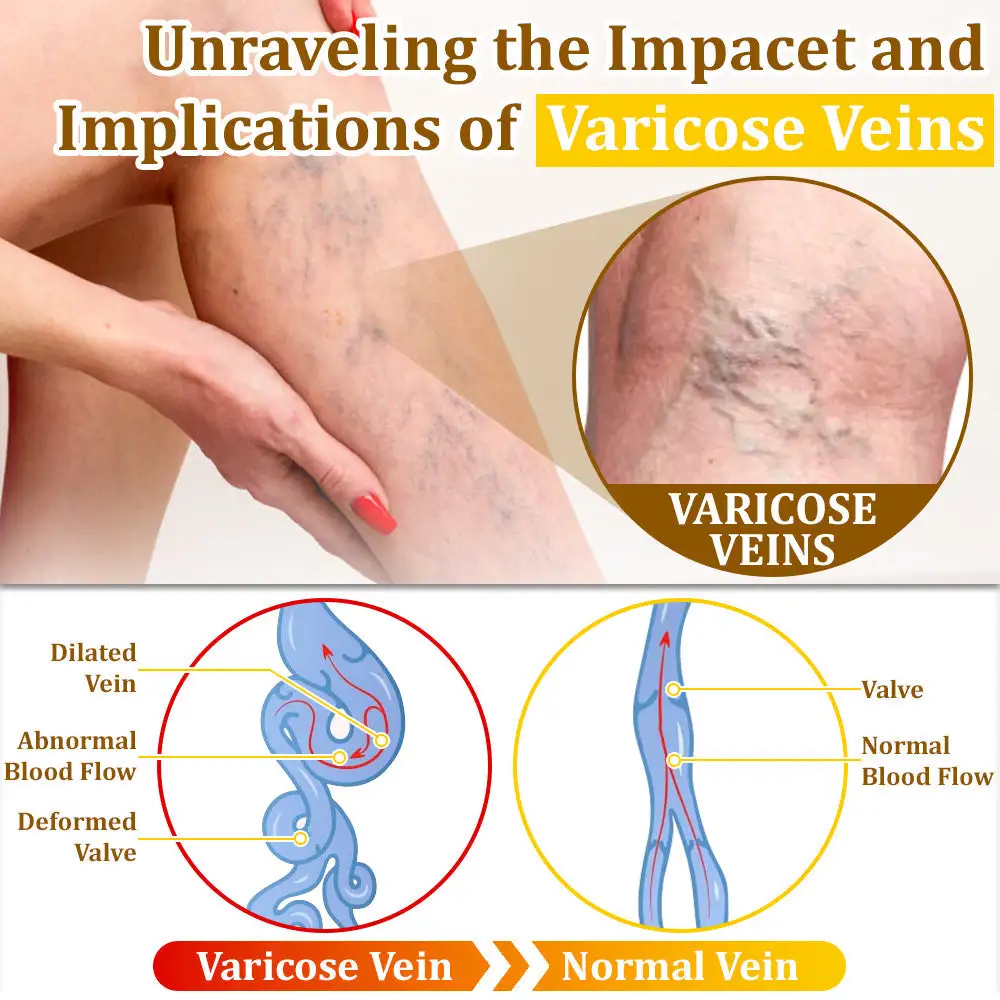 Bee Venom Treatment Cream🐝: Treat Eczema, Psoriasis, Acne, Rosacea, Fungal Infections, Warts - Image 8