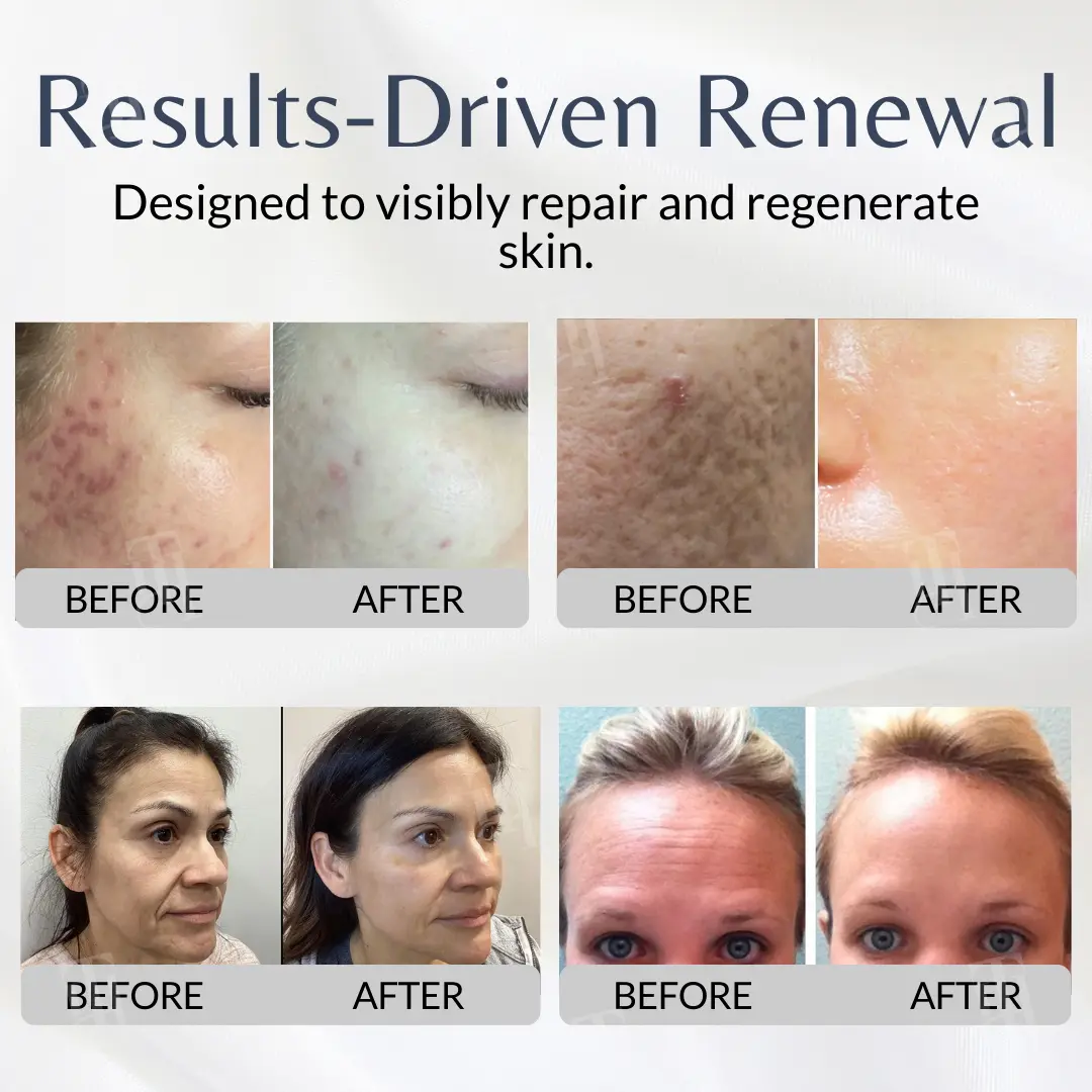Cellular Renewal System - Image 2