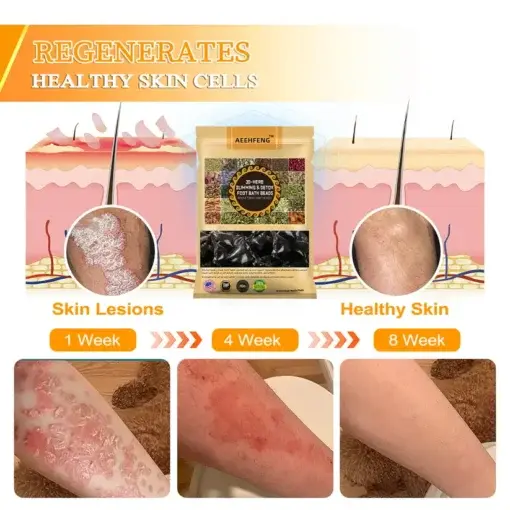 30-Herb Slimming & Detox Foot - Image 12