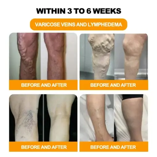 30-Herb Slimming & Detox Foot - Image 5