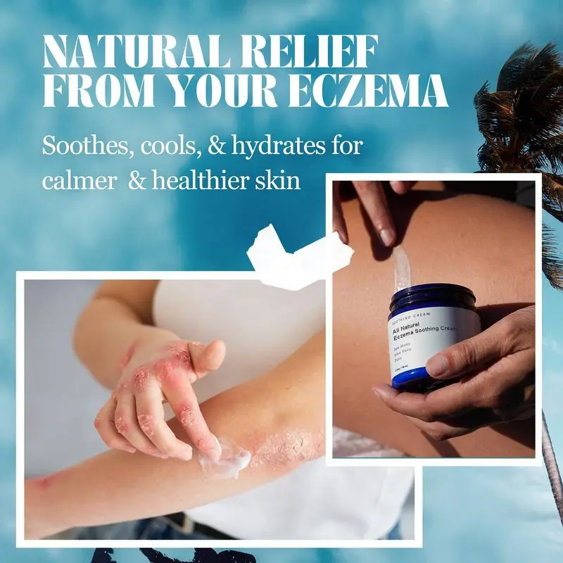 All Natural Eczema Soothing Cream - Image 2