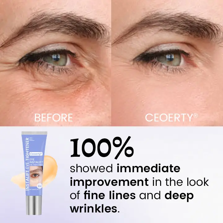 InstaLift Eye Tightener - Image 2