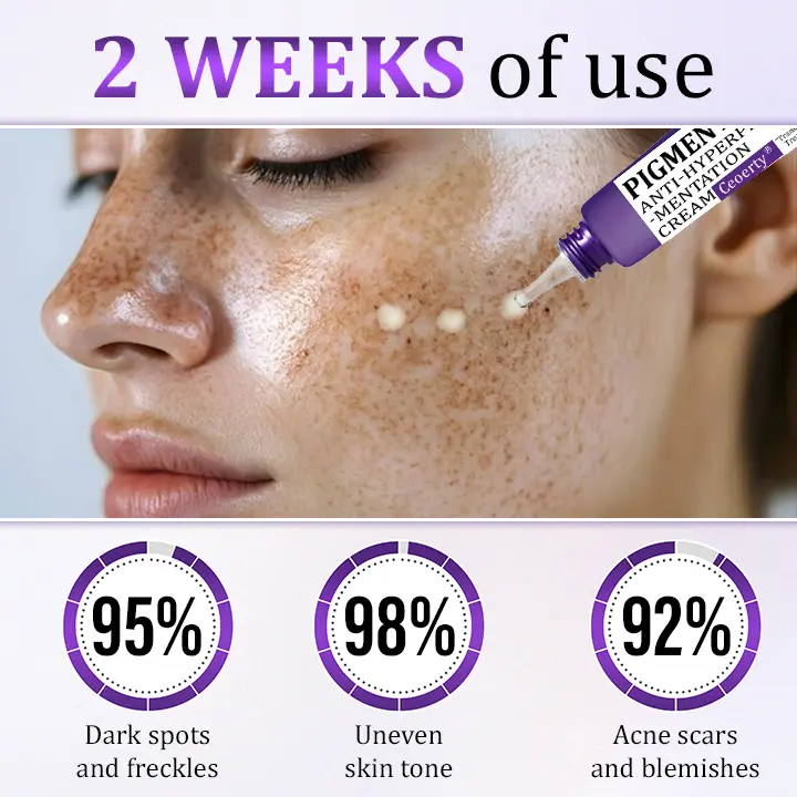 PigmentaX ProFade Anti-Hyperpigmentation Cream - Image 3