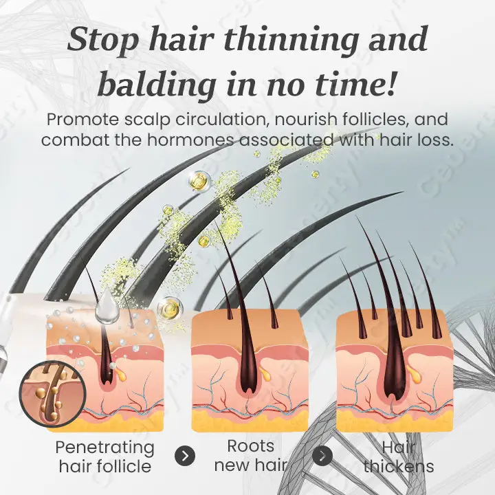 SheddStop Pro-Strength Hair Spray - Image 6