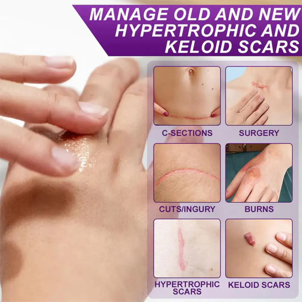 Stem Cell Scar Gel - Image 3
