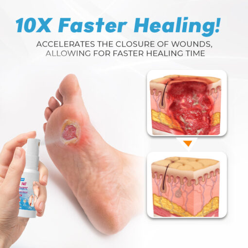 Fast Diabetic Wounds Healing Spray - Image 4