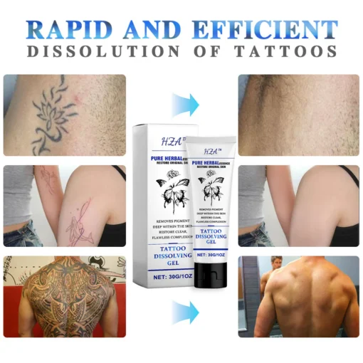 Tattoo Dissolving Gel - Image 7