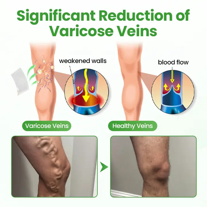 VeinHeal Microneedle Patch - Image 3