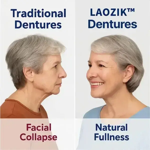 Custom-Fit Functional Dentures — Perfectly Fitted in Minutes at Home - Image 9