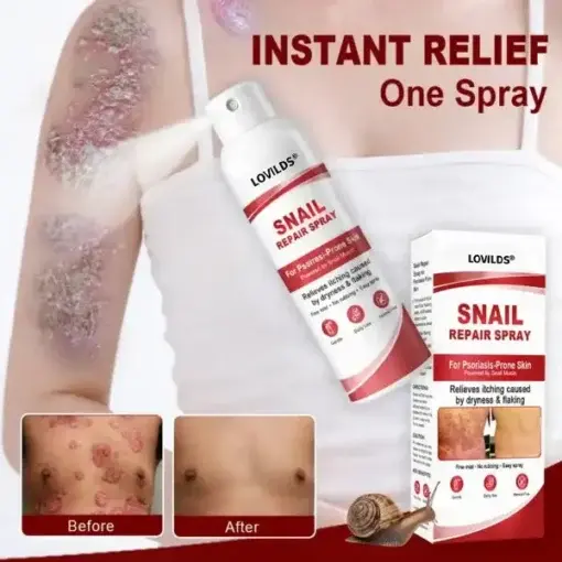 Snail Repair Spray for Itchy, Flaky Psoriasis Skin - Image 2