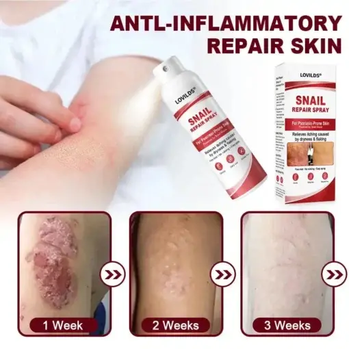 Snail Repair Spray for Itchy, Flaky Psoriasis Skin - Image 6