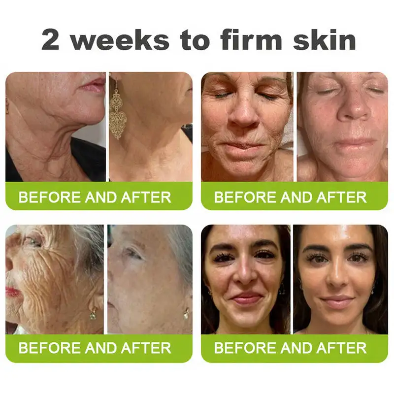 Wrinkle-Lift Tightening Cream See firmer, smoother skin in as little as 3 days - Image 7