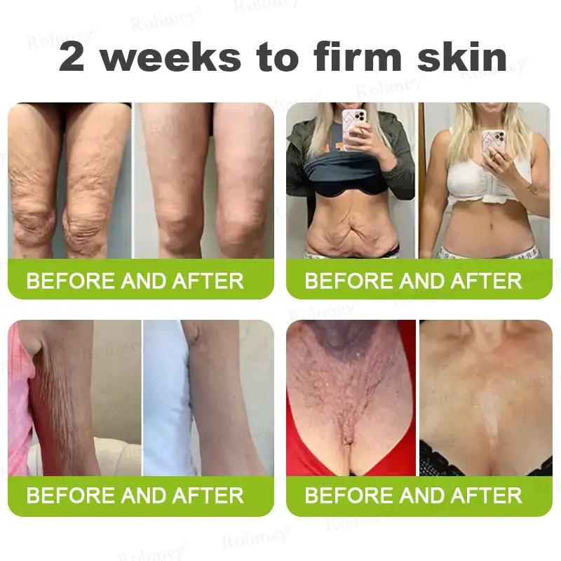 Botox & Retinol Shot - Eraser for Deep Wrinkles - Sagging Jowls & Puffy Eyes - Image 4