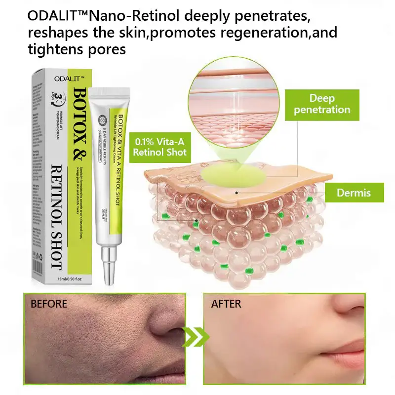 Botox & Retinol Shot - Eraser for Deep Wrinkles - Sagging Jowls & Puffy Eyes - Image 9