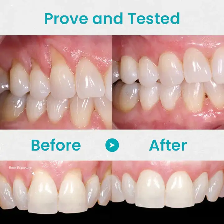 Gum Shield Therapy Gel - Image 3