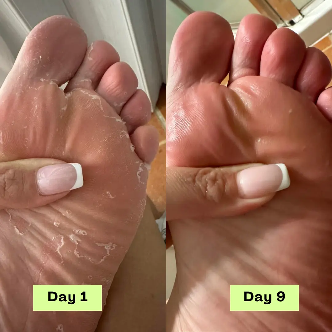 AntiFungal Relief Soap Bar - Image 5