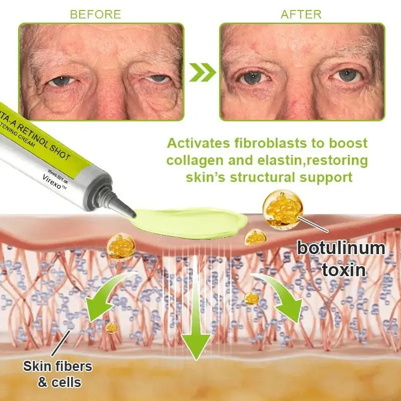Botox & Vita-A Retinol Shot Wrinkle-Lift Tightening cream - Image 19