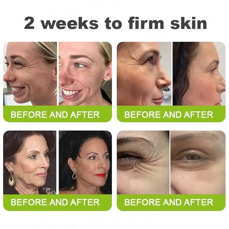 Botox & Vita-A Retinol Shot Wrinkle-Lift Tightening cream - Image 7