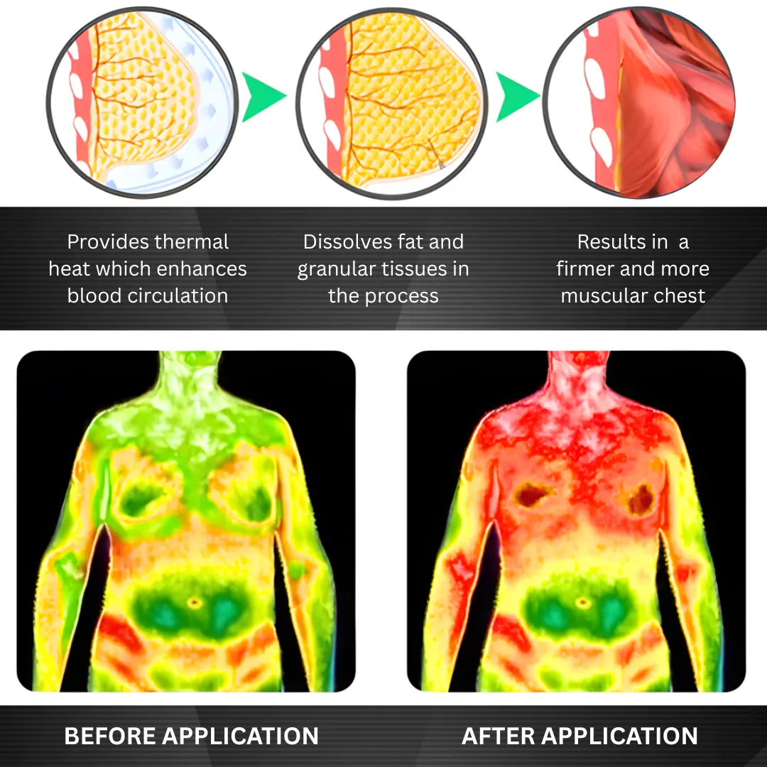 Gynecomastia 3 in1 Nano Microneedle Patch - Image 6