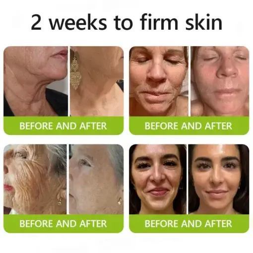 Peptide-Infused Firming Shot Dermatologist-Approved Formula for Powerful Lifting Visibly De-puffing - Image 2
