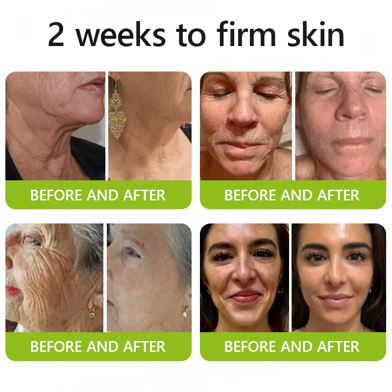 BOTOX & VITA A RETINOL SHOT Anti-Wrinkle Lifting & Firming Cream - Image 4