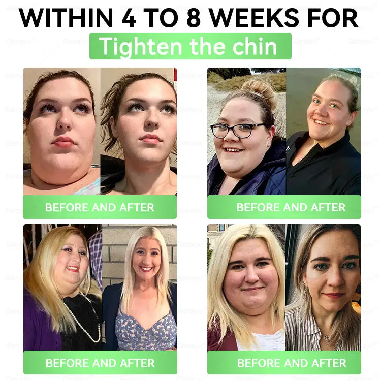 𝐌𝐨𝐫𝐢𝐧𝐠𝐚 × 𝐁𝐞𝐫𝐛𝐞𝐫𝐢𝐧𝐞 × 𝐀𝐌𝐏𝐊 𝟖-𝐁𝐞𝐧𝐞𝐟𝐢𝐭 𝐒𝐥𝐢𝐦𝐦𝐢𝐧𝐠 & 𝐌𝐞𝐭𝐚𝐛𝐨𝐥𝐢𝐜 𝐍𝐚𝐧𝐨 𝐌𝐢𝐜𝐫𝐨𝐧𝐞𝐞𝐝𝐥𝐞 𝐏𝐚𝐭𝐜𝐡 - Image 3