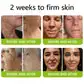 BOTOX & VITA A RETINOL SHOT Wrinkle Lift Tightening Cream - Image 27