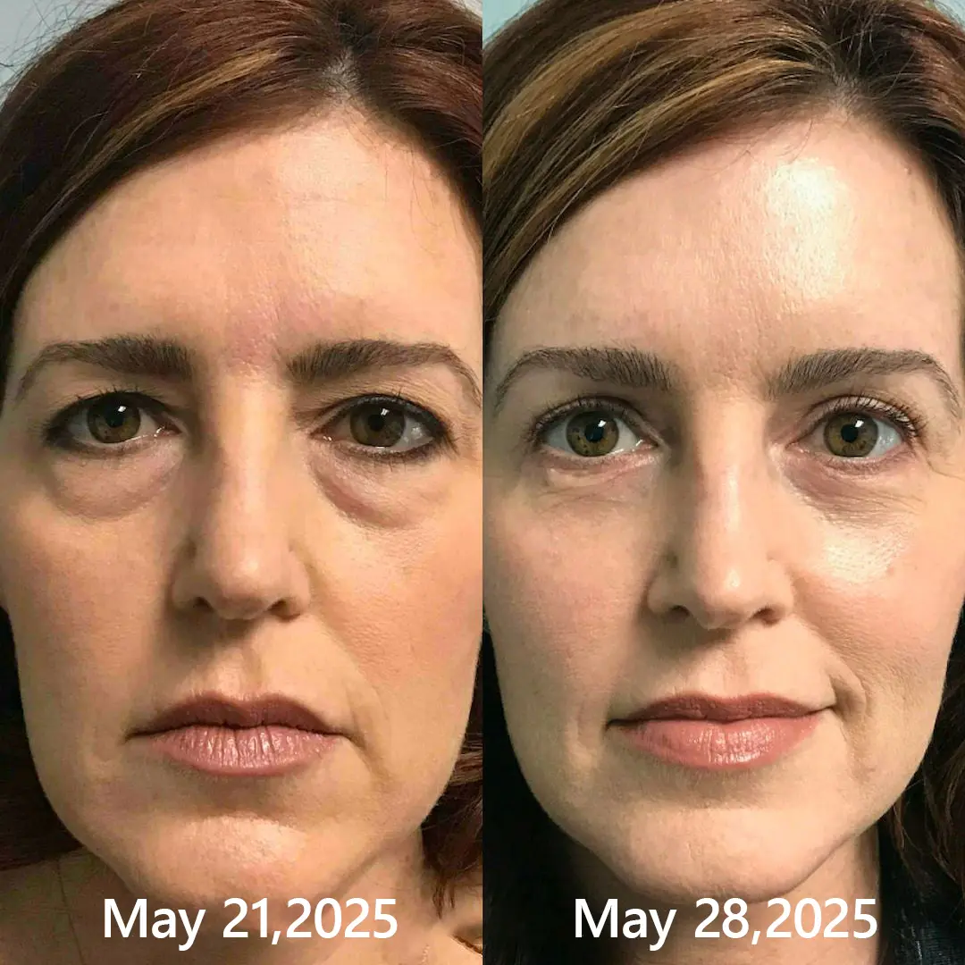 BOTOX & VITA A RETINOL SHOT Wrinkle Lift Tightening Cream - Image 38