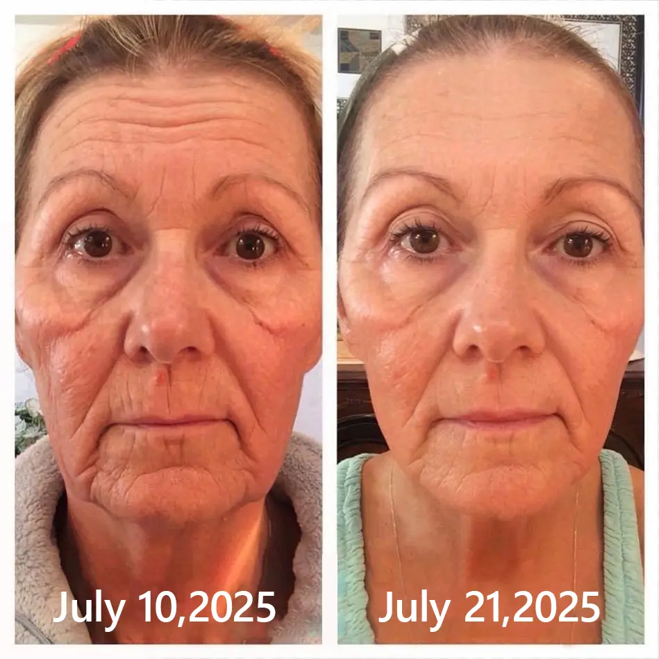 BOTOX & VITA A RETINOL SHOT Wrinkle Lift Tightening Cream - Image 39