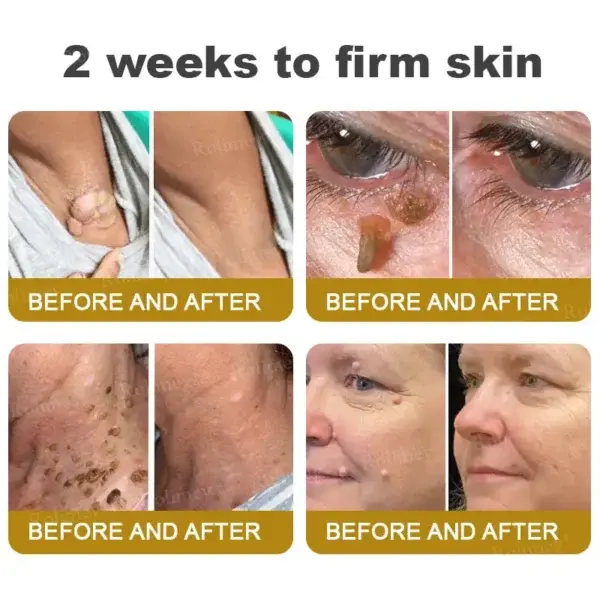 Bee Venom Skin Comprehensive Cream - Image 4