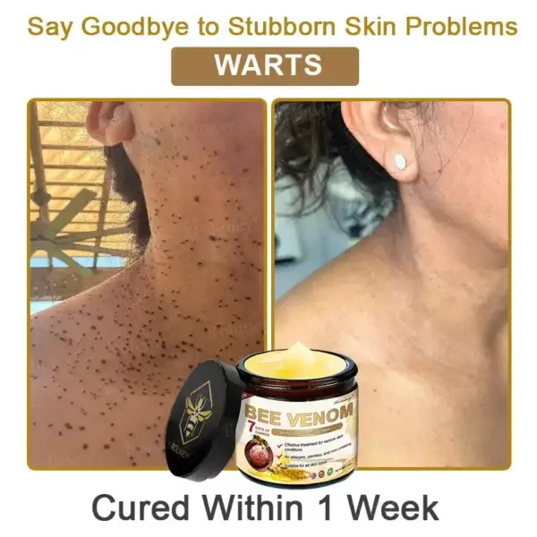 Botox Bee Venom Skin Treatment Cream - Image 9