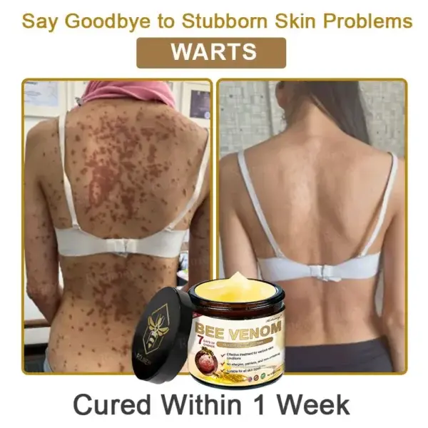 Botox Bee Venom Skin Treatment Cream - Image 8